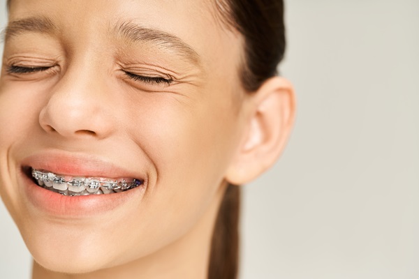 Braces For Teens: What Are Your Options?