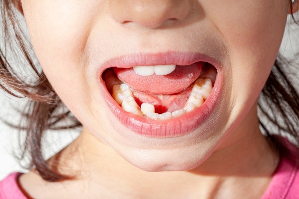 How Phase   Orthodontics Can Prevent More Serious Future Problems
